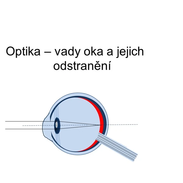 Optika - vady oka a jejich odstranění