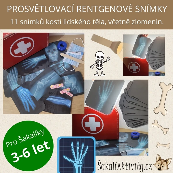 Prosvětlovací obrázky - RENTGENOVÉ SNÍMKY
