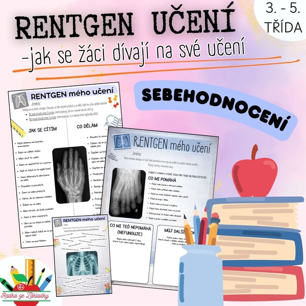 RENTGEN UČENÍ – SEBEHODNOCENÍ (jak se žáci dívají na své učení)