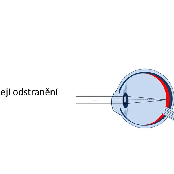 Optika, lidské oko, vady oka a její odstranění